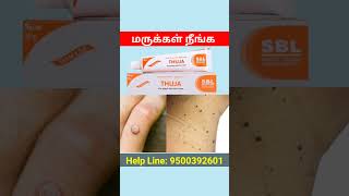 skin tag removal cream in india tamil dermatosis papulosa nigra removal DPN home remedy skincare [upl. by Doak]