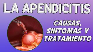 LA APENDICITIS Causas síntomas diagnóstico y tratamiento [upl. by Enak]