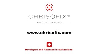 CHRISOFIX®  Introduction video [upl. by Jolanta]