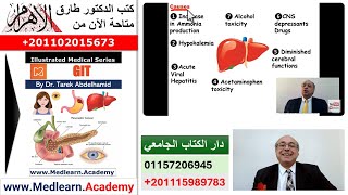 Acute Hepatic Coma internalmedicine cme medicaleducation ecg محاضراتباطنة medical [upl. by Kronick806]