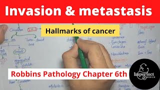 Invasion and Metastasis Hallmarks of CancerRobbins pathology chapter 6Neoplasiarobbinspathology [upl. by Cataldo]