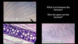 Identifying Cartilage  Review and Practice Questions [upl. by Vinn]