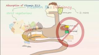 Megaloblastic Anemia Part 1 Vitamin B12 Deficiency Anemia [upl. by Nylyram128]