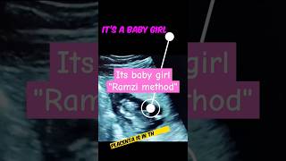 Its baby girl ultrasound  RAMZI THEORY shorts ultrasound genderreveal [upl. by Viki454]