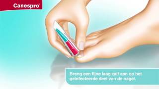 Canespro Behandeling Voor Schimmelnagels  TV Reclame [upl. by Hpsoj]