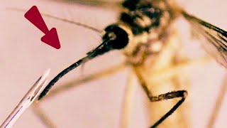 A closer look at Mosquito under the microscope Zoomphilic [upl. by Edyak]