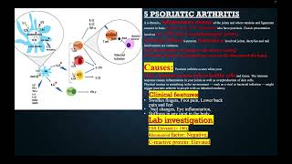 DIFFERENTIAL DIAGNOSIS AND MANAGMENT OF MONOARTHERITIS [upl. by Deery]