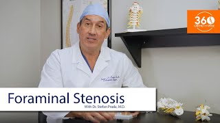 Foraminal Stenosis  360 Ortho amp Spine [upl. by Lipsey706]