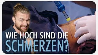 Wie SCHMERZHAFT ist eine Haartransplantation [upl. by Tem]