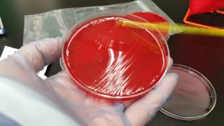 Microbiology Anaerobic primary setup from a stock culture [upl. by Rhines]