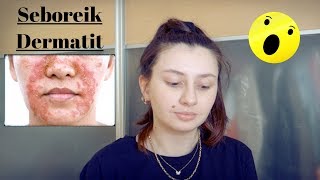 Seboreik Dermatit vs Egzama  Deneyimlerim Ürünler [upl. by Tuorah760]