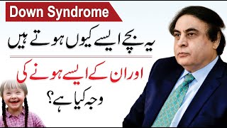 What Is Down Syndrome  Causes Signs amp Symptoms And Treatment  By Dr Khalid Jamil Akhtar [upl. by O'Rourke]