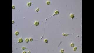 Cytoplasmic movement between cells of Chlorarachniophyte クロララクニオン藻の細胞間における原形質の移動 [upl. by Nirra385]