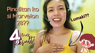 MARVELON28 VS DIANE35 PILL REVIEW amp RESULT Mommy Vlogs [upl. by Viviane937]