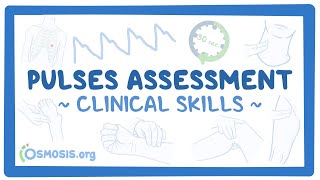 Clinical Skills Pulses assessment [upl. by Edin]