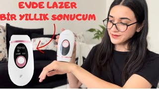 XIAOMI İNFACE İPL 1 YILLIK SONUCUM evdelazer [upl. by Idissac]