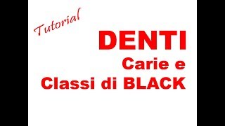 METASALUTE tutorial DENTI  carie e classi di black [upl. by Farand784]