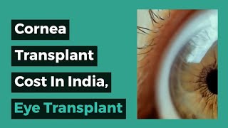 Cornea Transplant in India Eye Transplant Cost in India [upl. by Wehhtam]