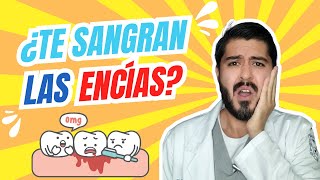 ¿Gingivitis o Periodontitis Como prevenir la enfermedad de las encías [upl. by Waterer]