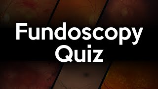 Fundoscopy Quiz [upl. by Retxed]