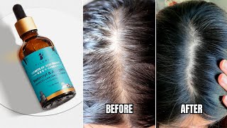 Pilgrim Redensyl amp Anagain Hair Serum For Hair Regrowth  Price Results Ingredients How To Apply [upl. by Queston]