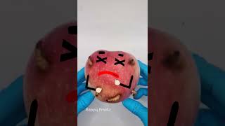 Apple Surgery Saving Our Sweet Apple from Pesky Worms shorts animation fruitsurgery [upl. by Atiuqin]