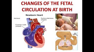 CHANGES OF THE FETAL CIRCULATION AT BIRTH [upl. by Notlrahc]