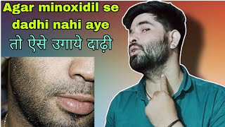 Agar minoxidil se bhi beard nahi aye toh kya kare  beard hair transplant kaise karaye [upl. by Noside785]