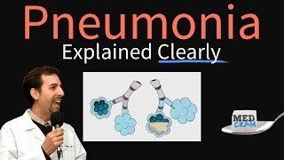 Pneumonia Explained Clearly by MedCramcom [upl. by Perkoff]