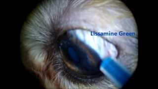 Nasolacrimal duct flush Lissamine green trick [upl. by Ytineres296]