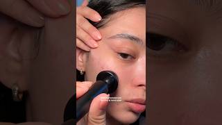 How to treat acne scars at home acnescars acnescarstreatment hyperpigmentation microneedling [upl. by Weldon]