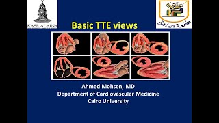 Basic Transthoracic Echocardiography TTE views [upl. by Lletnuahs]