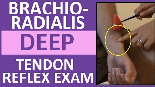 Brachioradialis Deep Tendon Reflex Examination  Nursing Head to Toe Assessment [upl. by Map612]