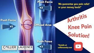 OA Knee Pain How an unloader knee brace works [upl. by Nueovas]