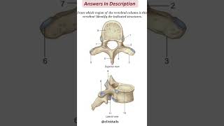 identify the parts of vertebrae humananatomy [upl. by Egor]