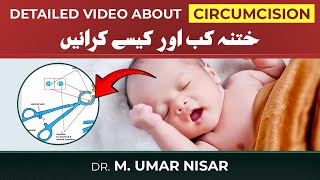 Detail video about Circumcision in Children  When and How to do it [upl. by Nahor630]