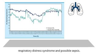 INVOS™ oximetry in the NICU Byte 10 NIRS to detect the hemodynamic impact of mechanical ventilation [upl. by Alton92]