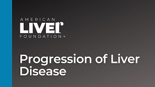 Progression of Liver Disease Overview  Animated [upl. by Rudin]