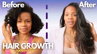 The Only Product That Worked  Hair Growth Update [upl. by Ocirne941]