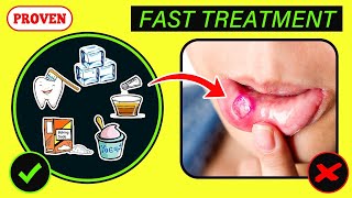 10 Fast Mouth Ulcer Remedies at Home [upl. by Jessamyn699]