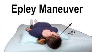 Epley Maneuver to Treat BPPV Dizziness [upl. by Mraz133]