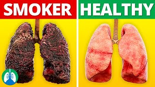 Smokers Lungs vs Healthy Lungs [upl. by Cilurzo335]