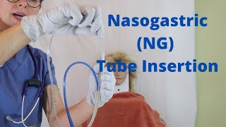 Nasogastric NG Tube Insertion [upl. by Eciryt]