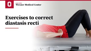 Exercises to correct diastasis recti  Ohio State Medical Center [upl. by Blancha45]