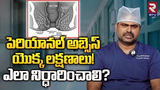 పెరియానల్ అబ్సెస్ యొక్క లక్షణాలు  PERIANAL ABSCESS Treatment Explianed By DrVenkateshwarlu  RTV [upl. by Euqinoj]