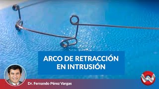 Confección y aplicación de un arco utilitario de retracción e intrusión [upl. by Yrbua]