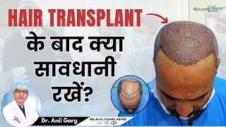 10 सावधानियां जो आपको जाननी चाहिए Hair Transplant के बाद  Care after Hair Transplant [upl. by Furiya]