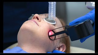 How does fractional CO2 laser resurfacing erase signs of aging [upl. by Rednave]