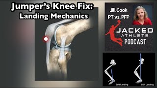 Jumper’s Knee Landing Mechanics Fix Patellar Tendon Pain [upl. by Corb]