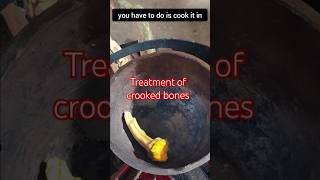 Treatment of crooked bones remedy entertainment information [upl. by Annairb834]